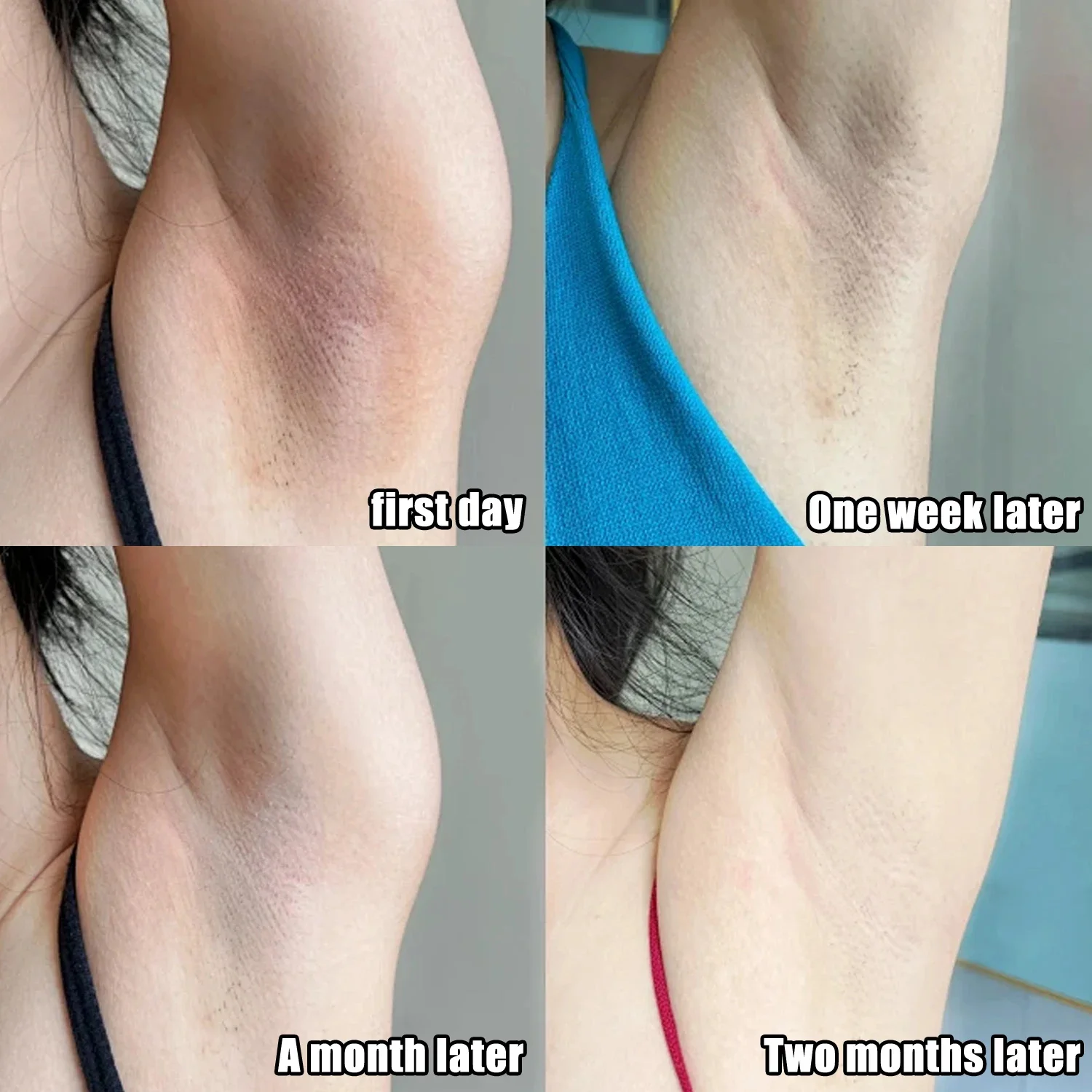 콜라겐 겨드랑이 미백 크림 (어두운 피부용), 겨드랑이 - Anti-Aging Face Cream 리뷰 및 가격