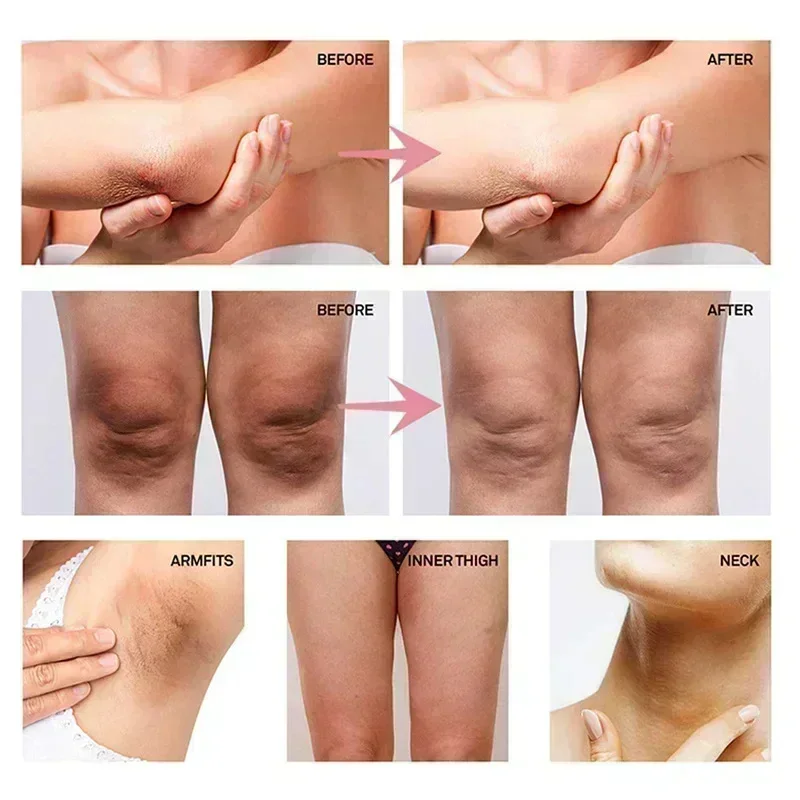 콜라겐 겨드랑이 미백 크림 (어두운 피부용), 겨드랑이 - Anti-Aging Face Cream 리뷰 및 가격