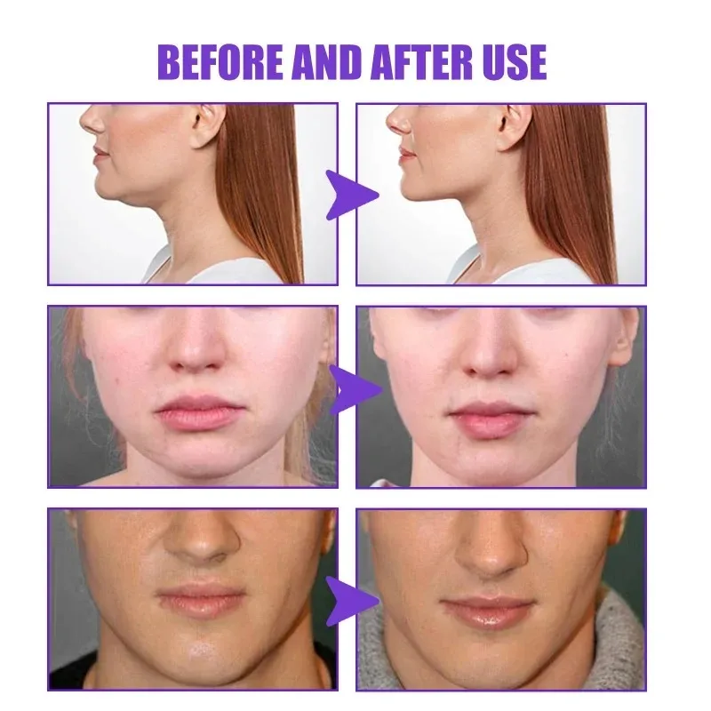 페이스 리프트 슬리밍 크림 슬리밍 퍼밍 V 자형 제거  - Anti-Aging Face Cream 리뷰 및 가격