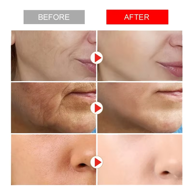 즉각적인 주름 제거 페이스 크림 안티에이징 탄력 리프팅 - Anti-Aging Face Cream 리뷰 및 가격