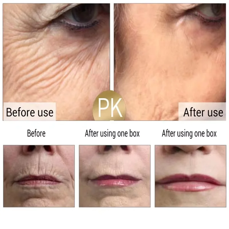 즉각적인 주름 제거 페이스 크림 안티에이징 탄력 리프팅 - Anti-Aging Face Cream 리뷰 및 가격